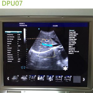 doppler ultrasound echo machines,used doppler ultrasound machines,doppler ultrasound scanner,doppler medical scan machines,doppler ultrasound machines,4d laptop ultrasound machines,portable ultrasound 4d
