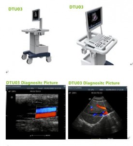 cheap trolley ultrasound machines,doppler ultrasound machines,trolley doppler ultrasound,doppler ultrasound scanner,dopper machines,trolley ultrasound machines