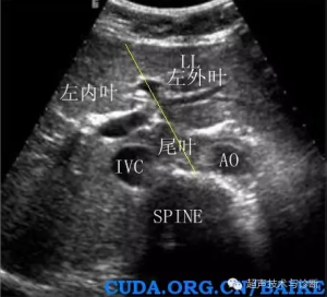 Laptop ultrasound machine,Laptop ultrasound machine price,used Laptop ultrasound machine,best laptop ultrasound machine,laptop ultrasound factory sell directly,price from medical ultrasound