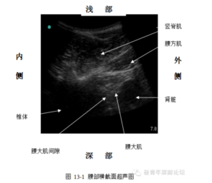 Ultrasound -guided regional anesthesia instruction