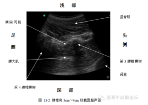 Ultrasound -guided regional anesthesia instruction