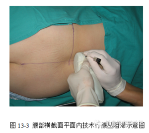 Ultrasound -guided regional anesthesia instruction