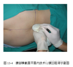 Ultrasound -guided regional anesthesia instruction