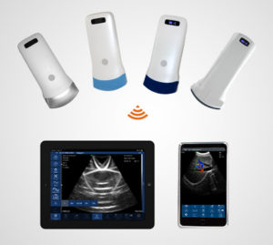 ultrasound probe